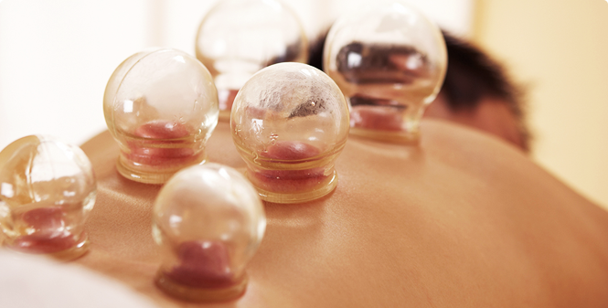 Cupping   $40